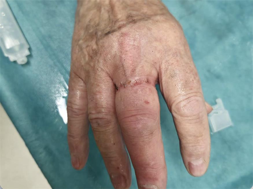 Die betroffene Person blieb bei dem Einsatz unverletzt.