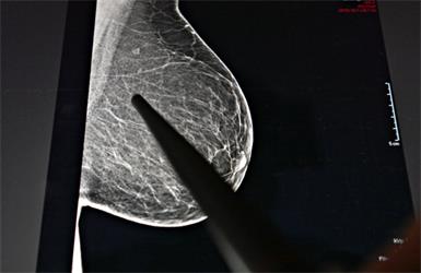 Häufigste Diagnose bei Frauen war Brustkrebs